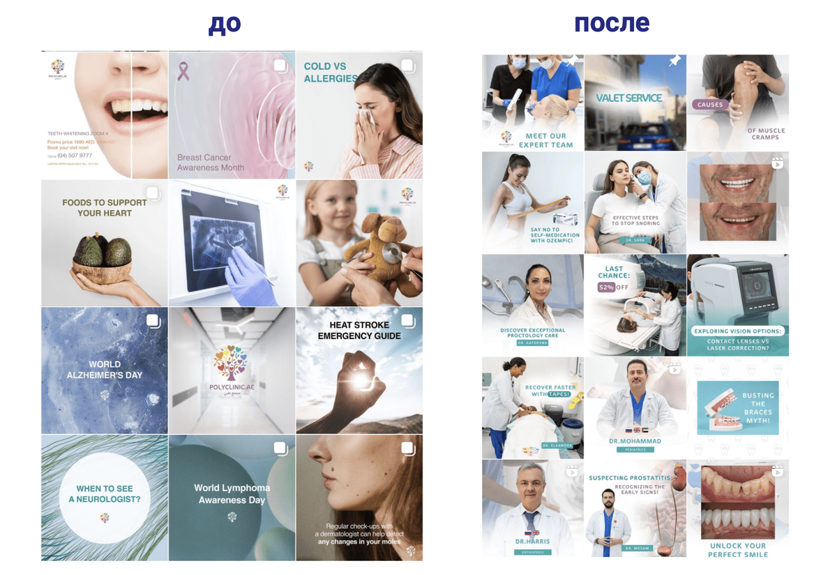 сетка профиля