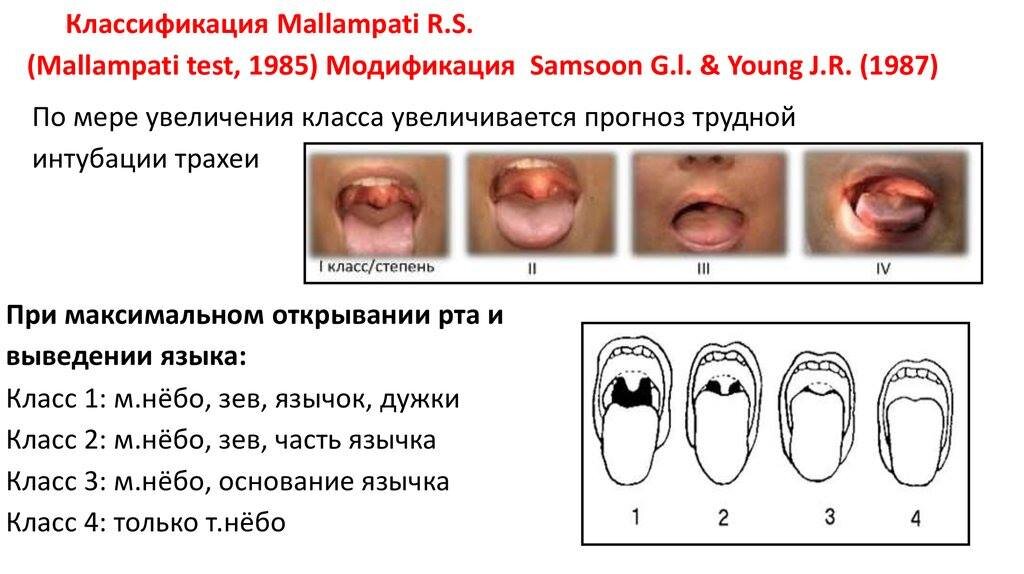 Лечение глоссита