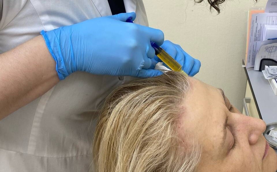 Процесс плазмотерапии