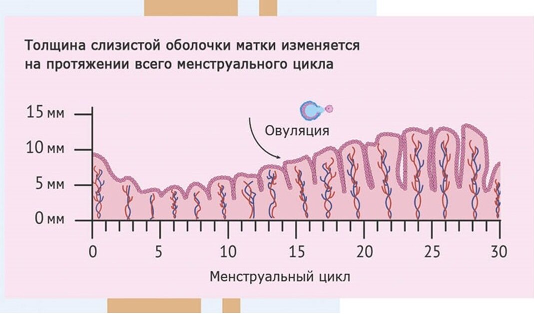 Эндометрий на 10 день