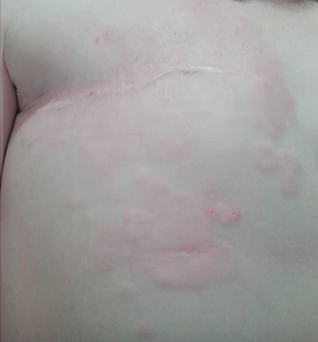 Какие то шишки