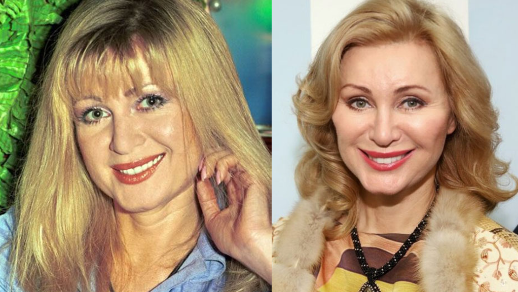 Вика цыганова до и после пластики