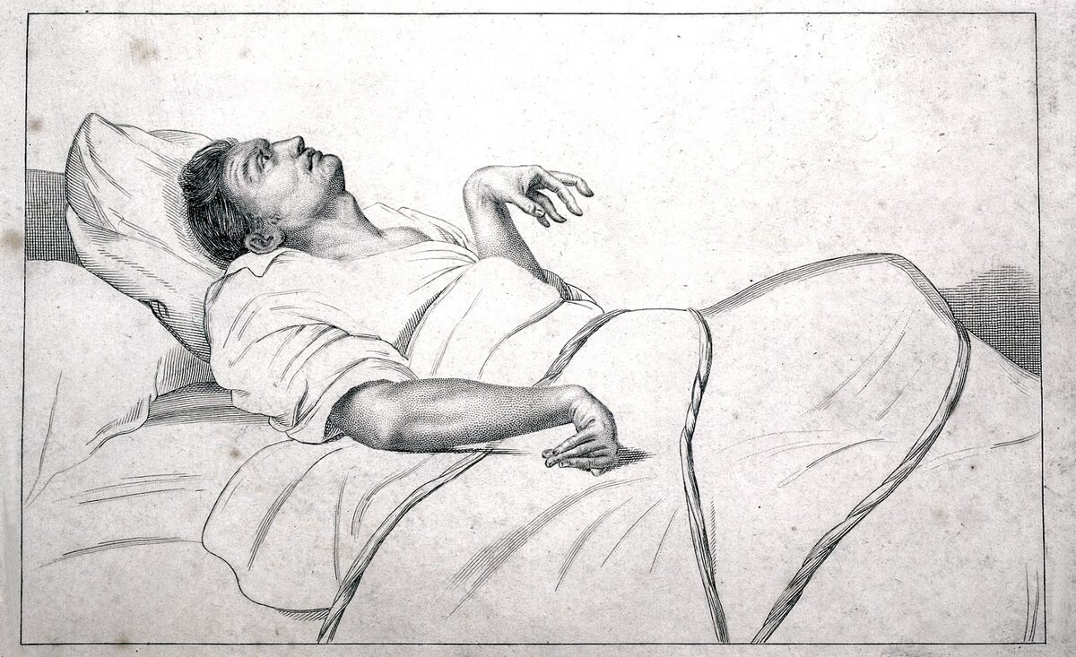 клинические формы шизофрении таблица. простая форма шизофрении. одна из форм шизофрении наследуется как рецессивный. 1 из форм шизофрении. 1 из форм шизофрении.