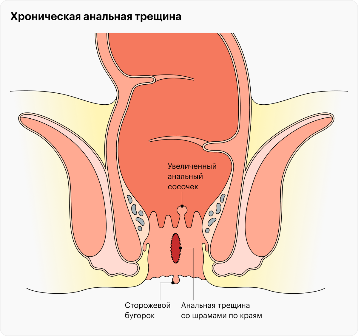 Анус — Википедия