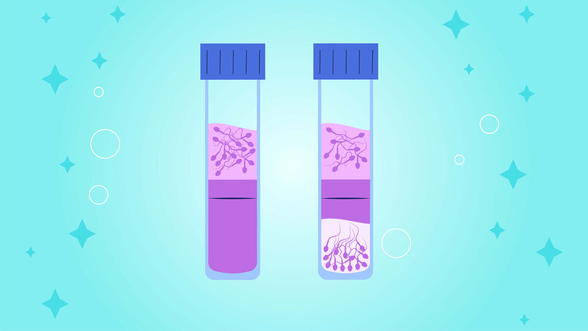 Градиентное центрифугирование по плотности при подготовке спермы к  инсеминации | Клиника репродукции NEW LIFE | Дзен