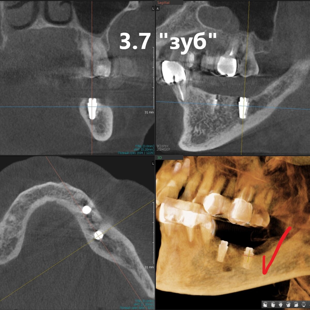 преображение внешности. перекраивать. перекраивать. скошенный подбородок. перекраивать.