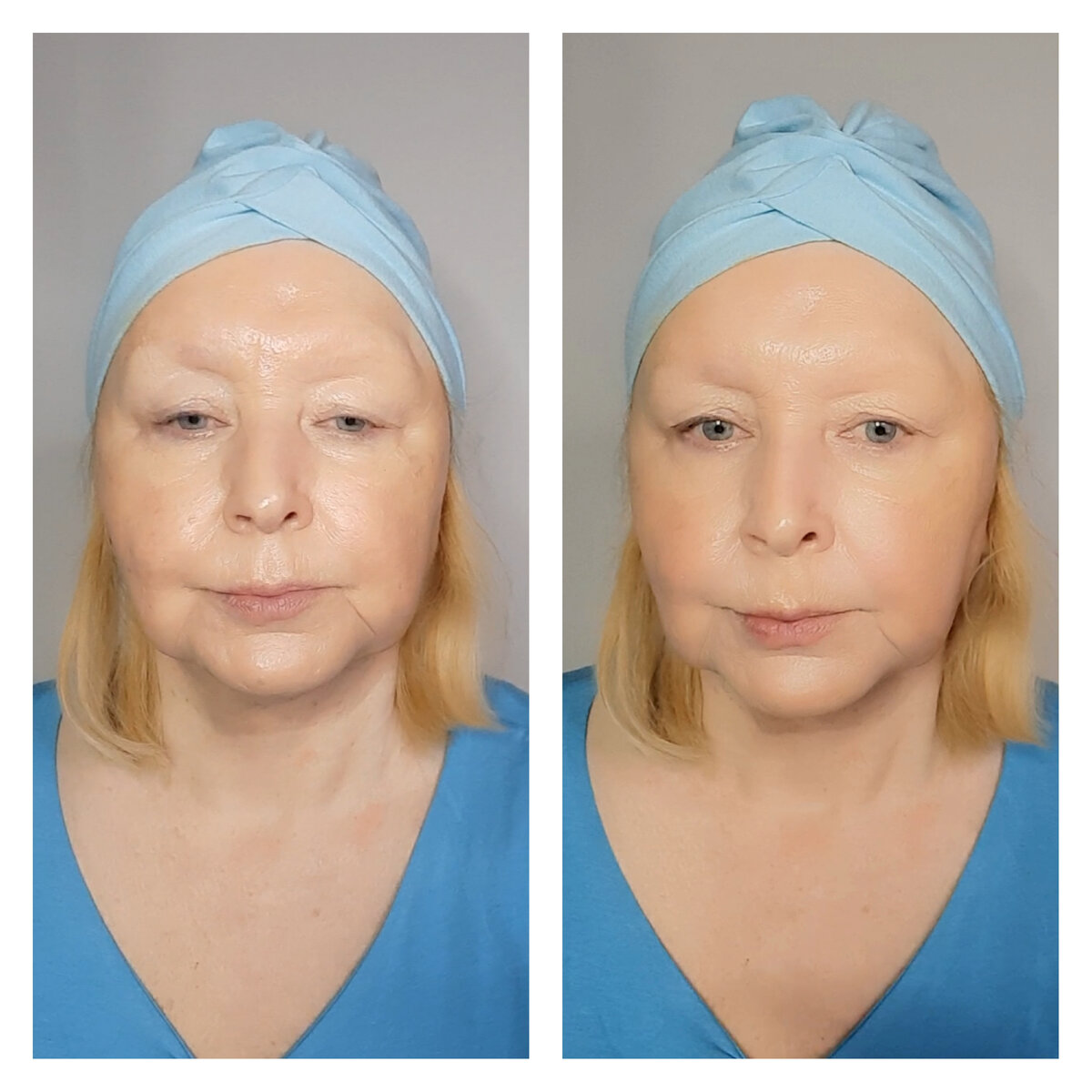 Мои фото. Слева без тонального средства, а справа с тональным и корректором вокруг глаз персикового цвета против синячков и с высветляющим корректором в носогубках и марионетках. Также использовано 2 оттенка тонального для эффекта лифтинга. Более светлый по центру лица и более темный по боковой части лица. 