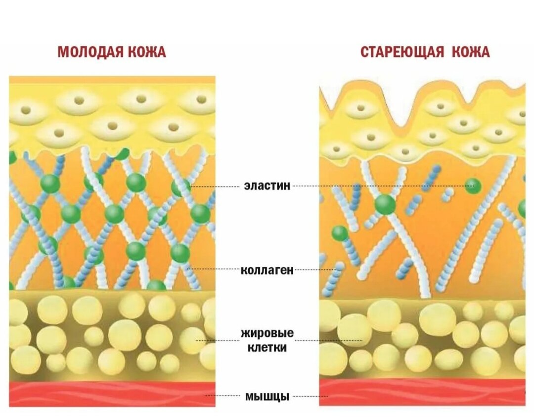 Скриншот сделан для наглядности из Яндекс картинки 