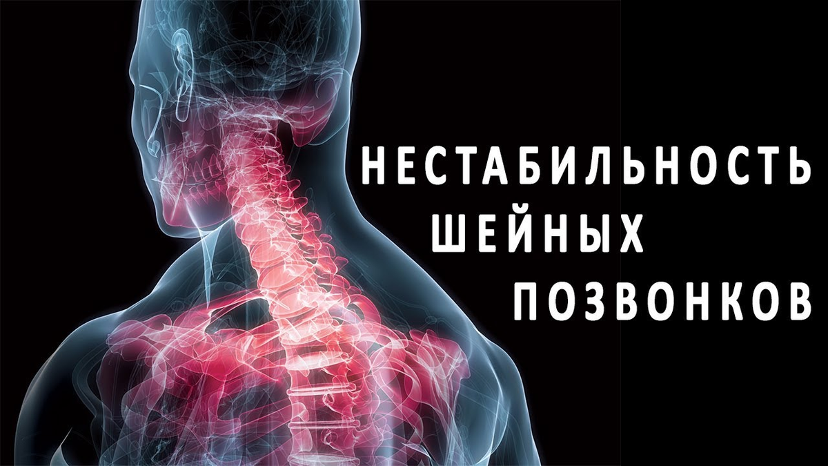 Нестабильность позвоночника - MedClinic