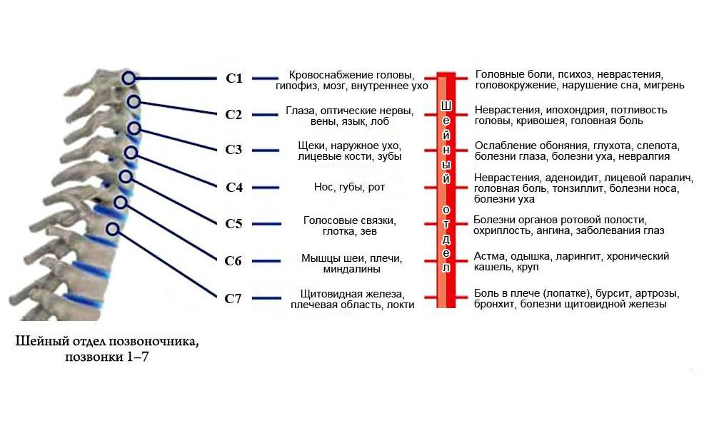 Температура поясница. Грыжа шейного отдела позвоночника с3-5. Сегмент с4-7 шейного отдела. С2 с3 позвонки шейного отдела.