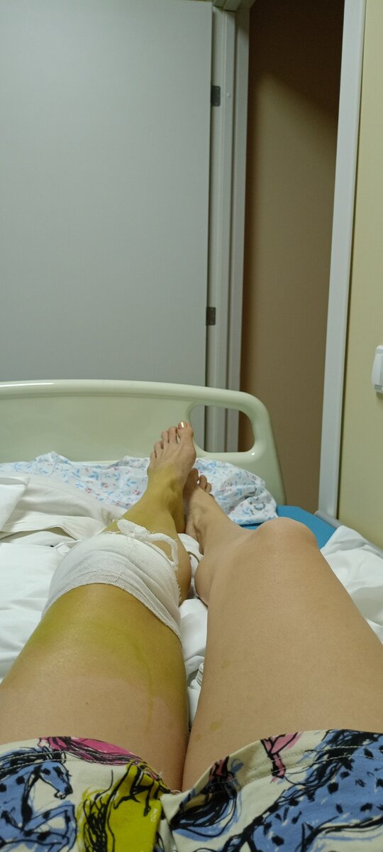 Как-то так. Никаких кровавых намотанных на коленку бинтов размером с футбольный мяч, как я видела в некоторых отзывах