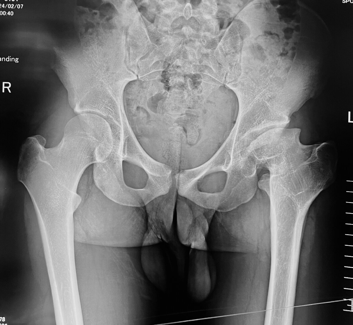 Вот такая картина была еще вчера утром