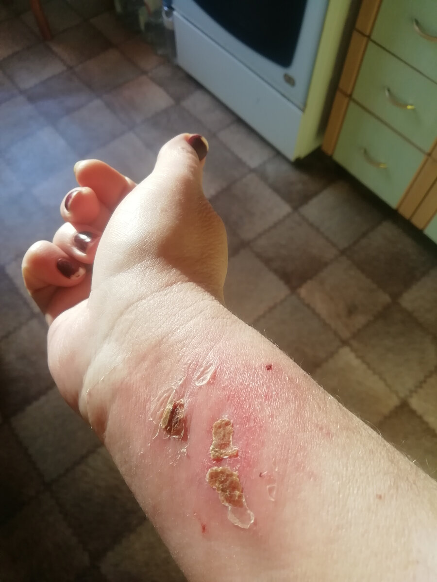 Отсюда не реально брать. Ожог. Да и нет её тут. 