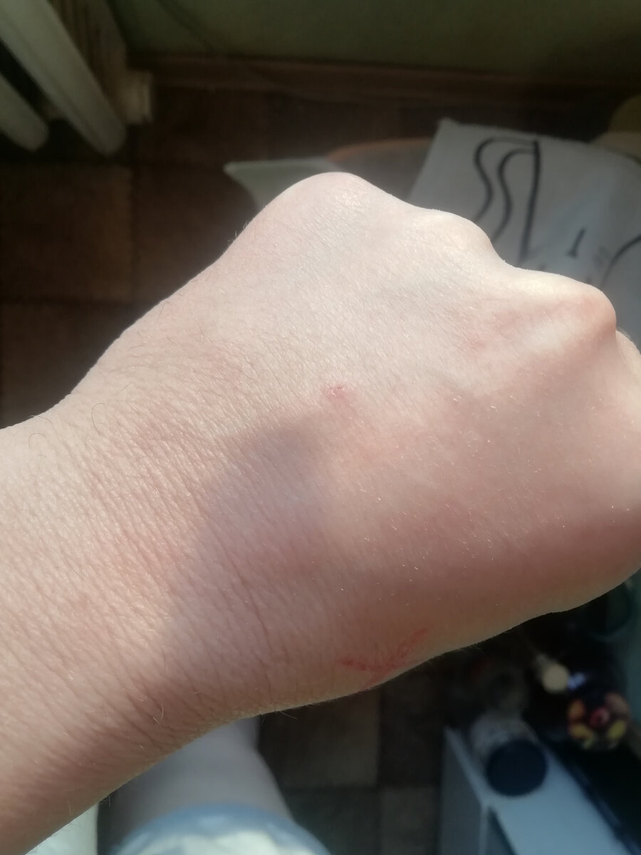 Вот мои единственные венки