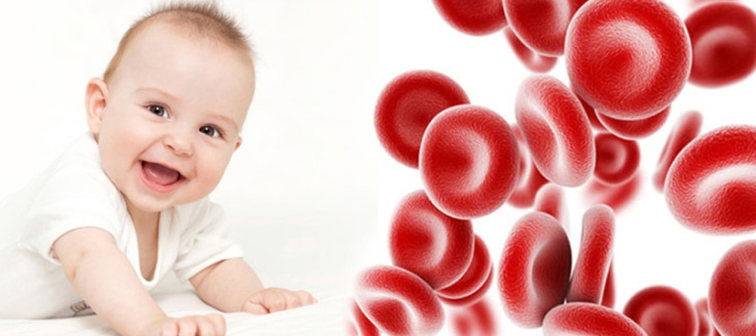 Железодефицитная анемия у детей. Железодефицитная анемия у новорожденных. Жда у детей. Анемия у детей раннего возраста.