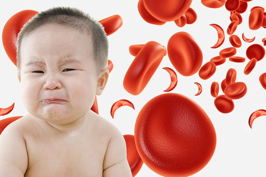 Железодефицитная анемия у детей. Жда у детей. Жда у новорожденных детей. Железодефицитная анемия у новорожденных.