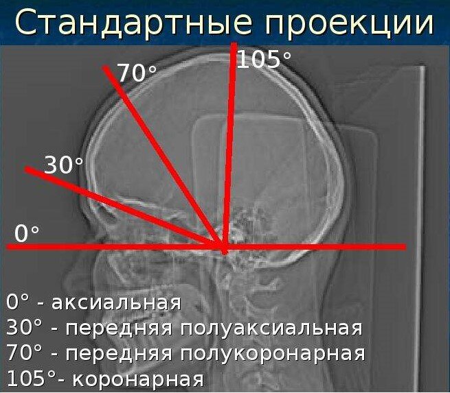 Проекции - картинка взята из интернета
