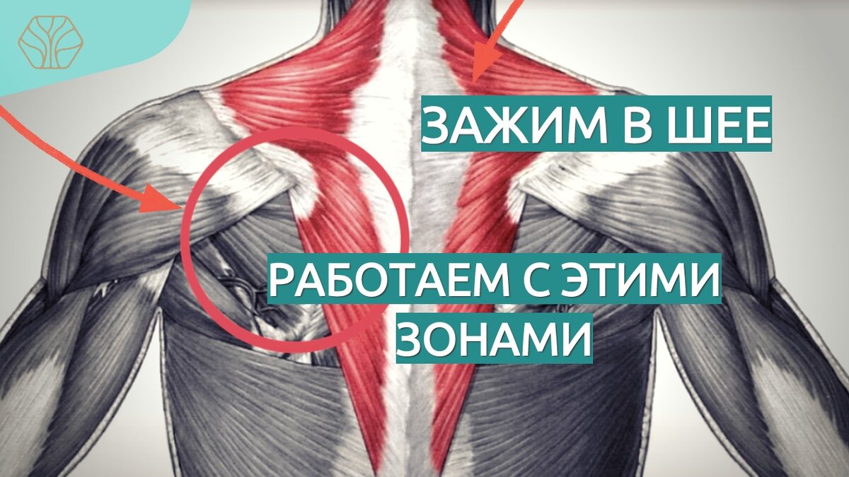 2 упражнения при сильном утреннем спазме мышц шеи — когда голову не ...
