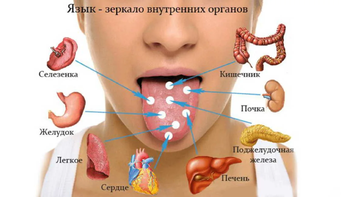 О чем говорит язык болезни. Заболевания по цвету языка. Болезни по языку определить.