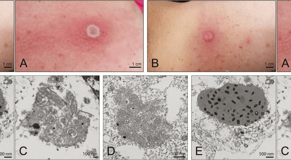   Joseph McLaughlin et al. / Clinical Infectious Diseases, 2017