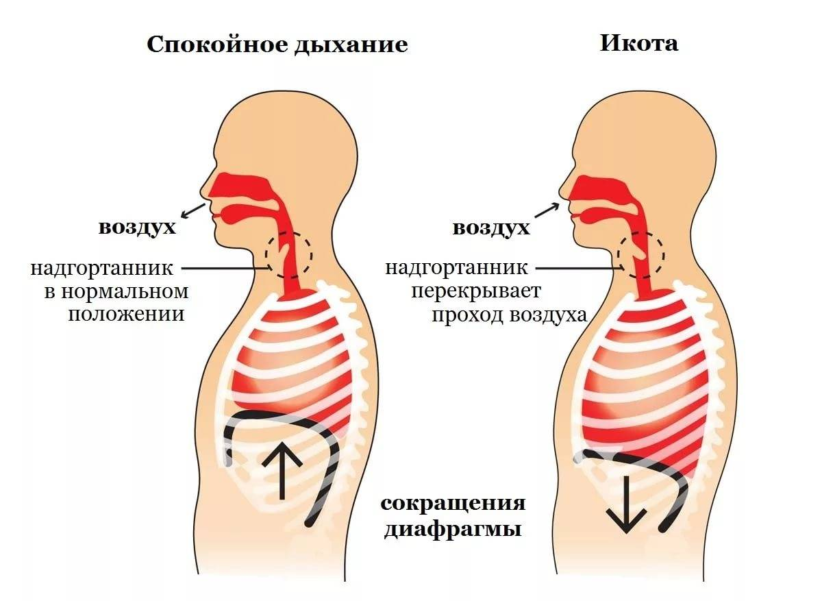 К чему икать