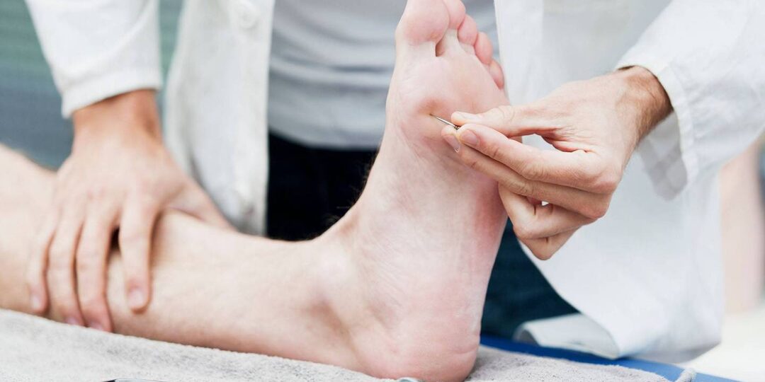 Что такое невропатия и ее последствия, что вызывает болезнь, как она развивается и как ее лечить?