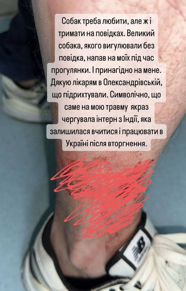 Пост пострадавшего в соцсети ( рану закрасила , ибо нежный Дзен может блокирнуть статью 🤷‍♀️)