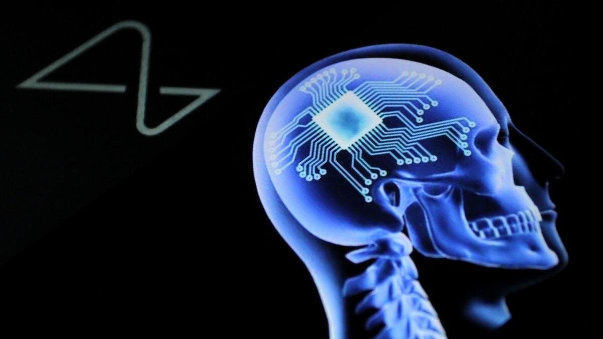 Презентация компании Neuralink по имплантации мозгового чипа в человеческий мозг. Фото: Zuma / TASS