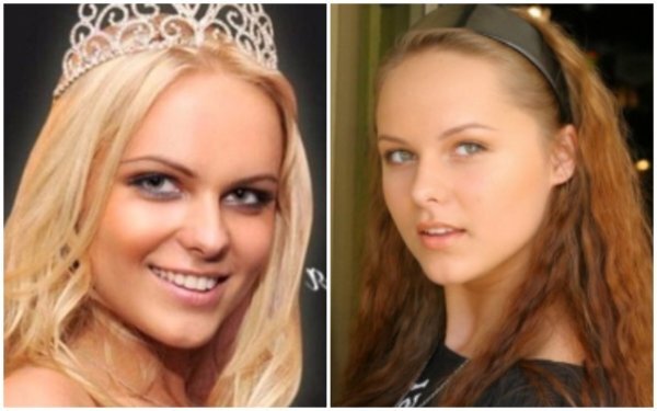 Ханна до операции и после фото пластические