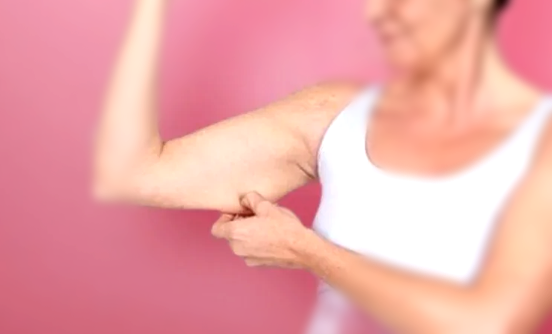 Первые признаки "обвисания" мышц