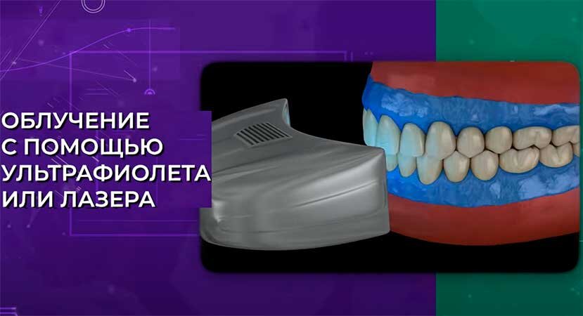 Облучением поверхности зуба с помощью ультрафиолета или лазера
