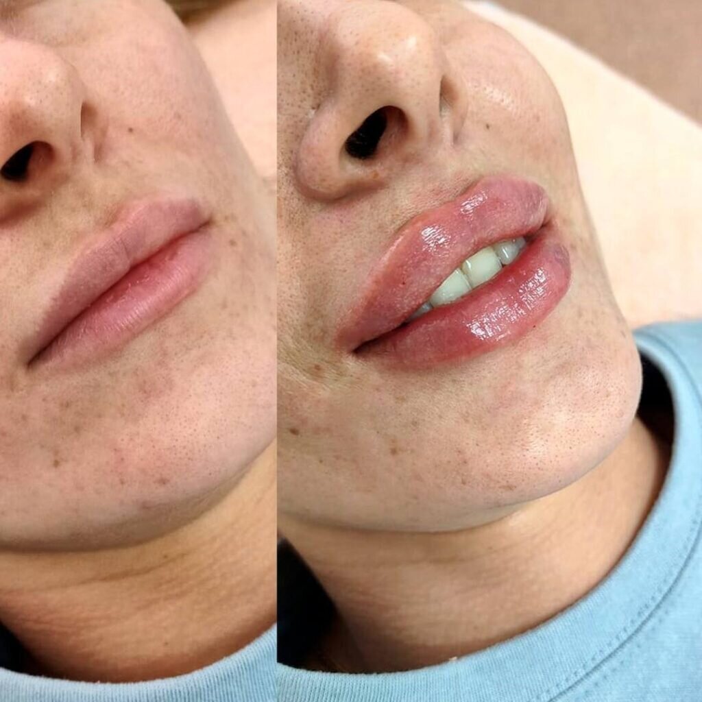    Фото: Виктория Халицкая