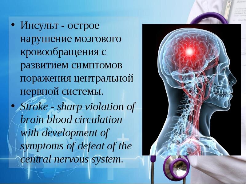 Лечение дисфункций мозга в Центре стимуляции мозга