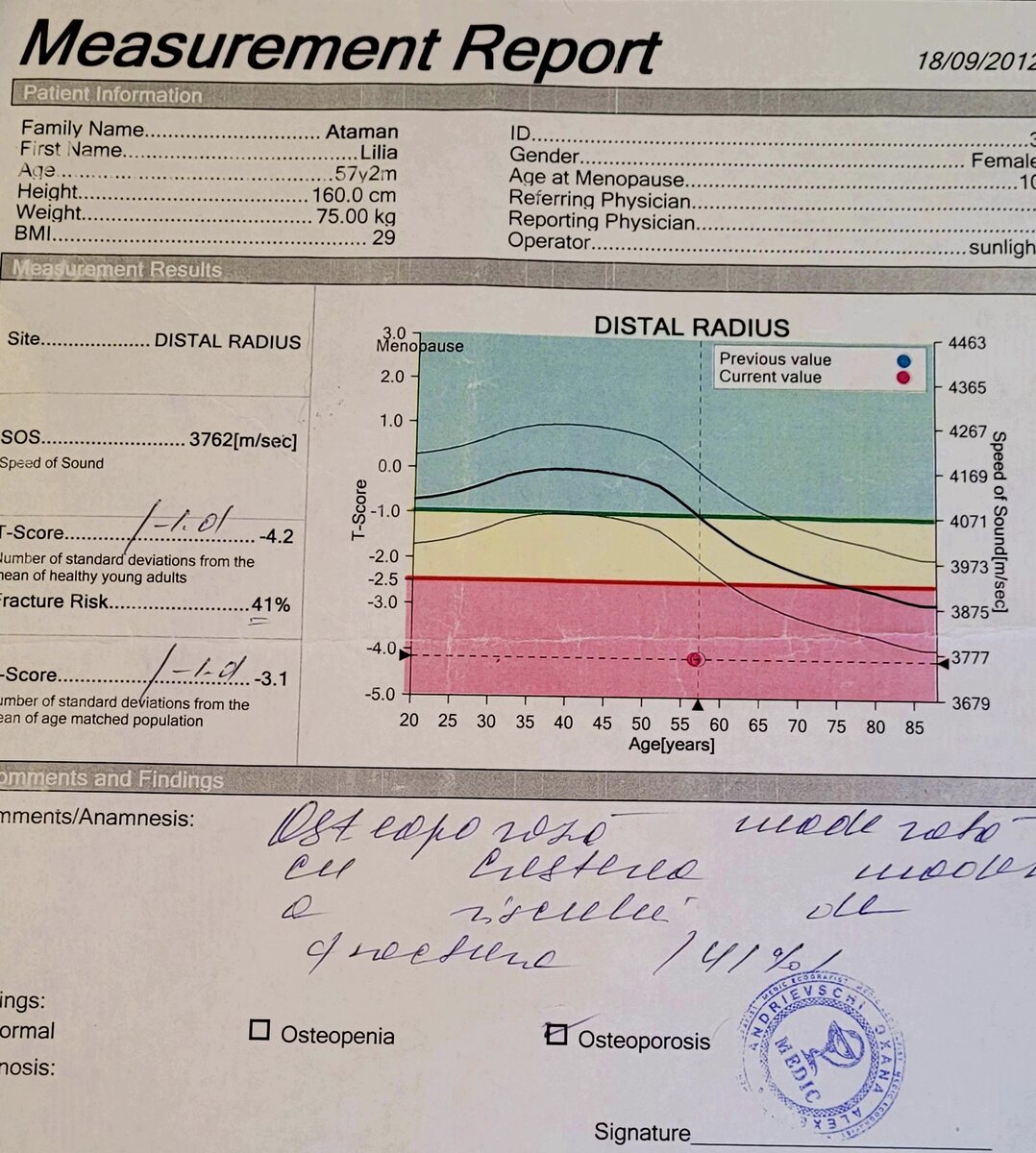 Результаты моей денситометрии