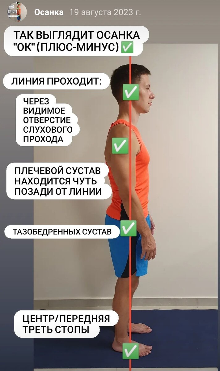 Норма осанки (плюс /минус).