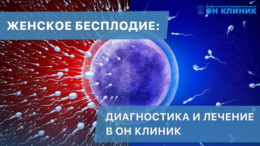 Женское бесплодие: диагностика и лечение в ОН КЛИНИК