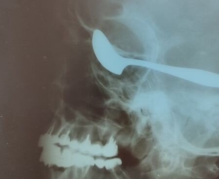    Министерство здравоохранения Чувашской Республики