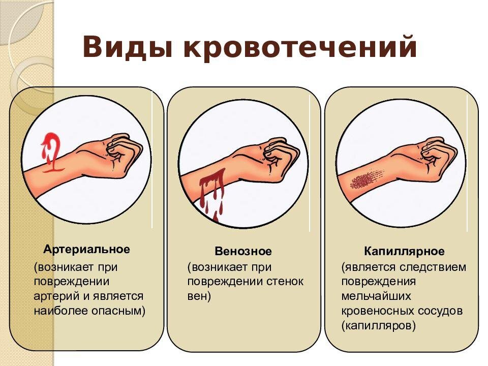 Первая помощь при наружном кровотечении