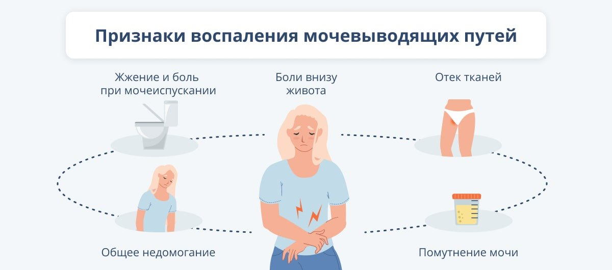 Цистит после секса. Как себе помочь? | Евгений Лешунов | Пластический хирург | Дзен