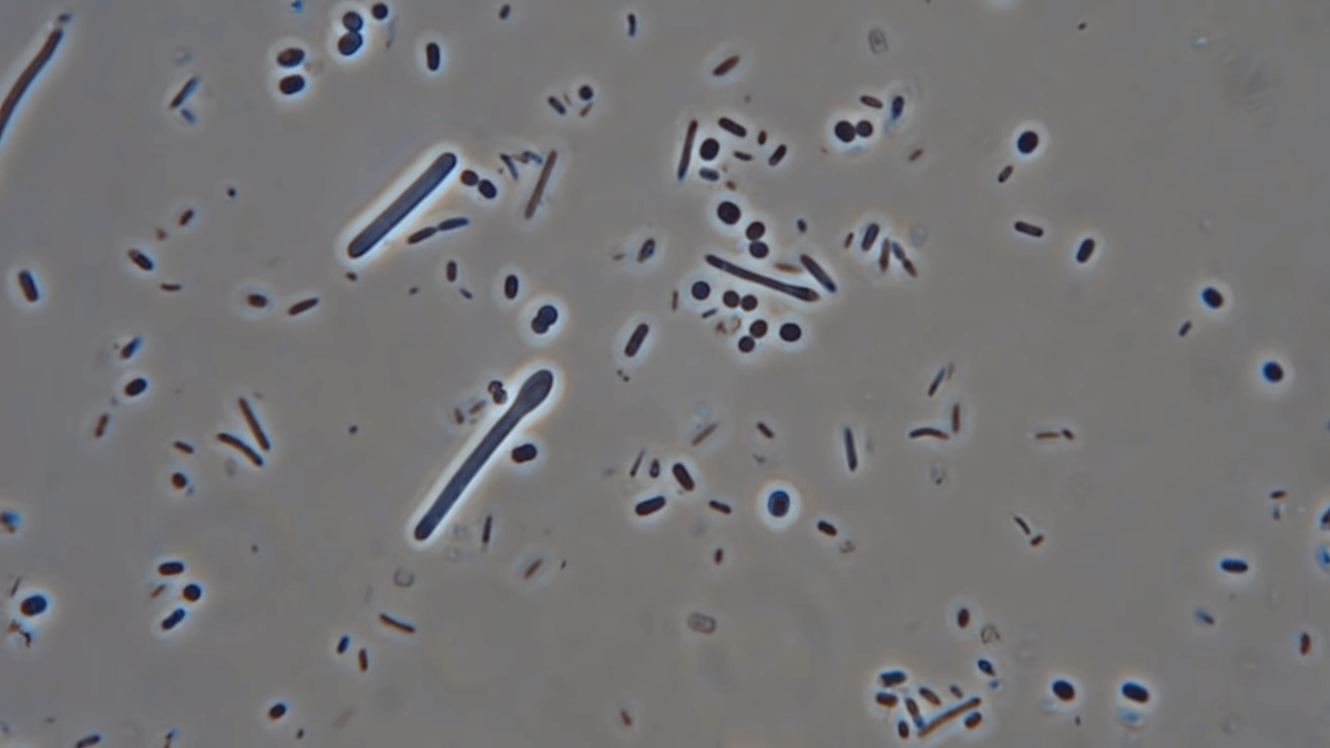    За разложение человеческого тела отвечает «некробиом» — бактерии и грибки
