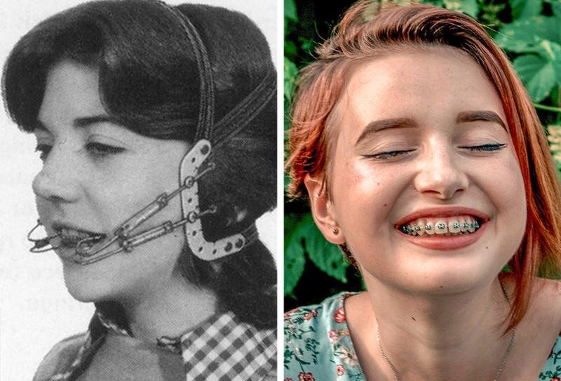 Как выглядели первые фото Новинки в стоматологической сфере за последние 10 лет Арион стоматологическое об