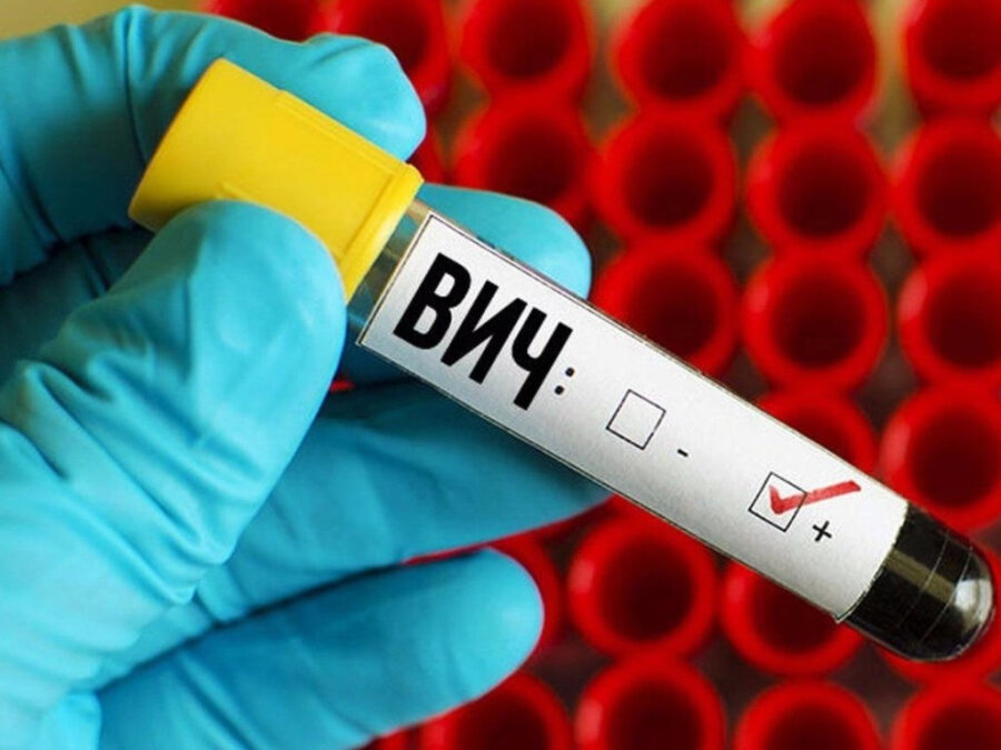     Минская область находится в тройке лидеров по распространению ВИЧ-инфекции в Беларуси