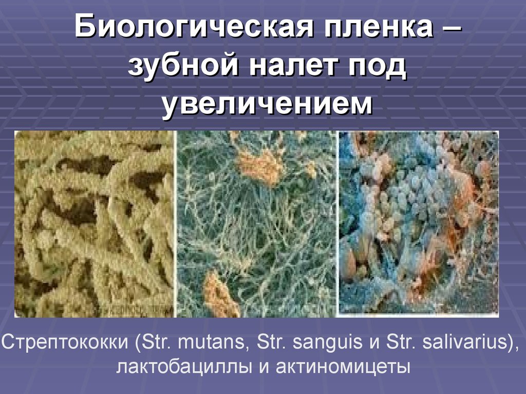 Зубной налет под микроскопом