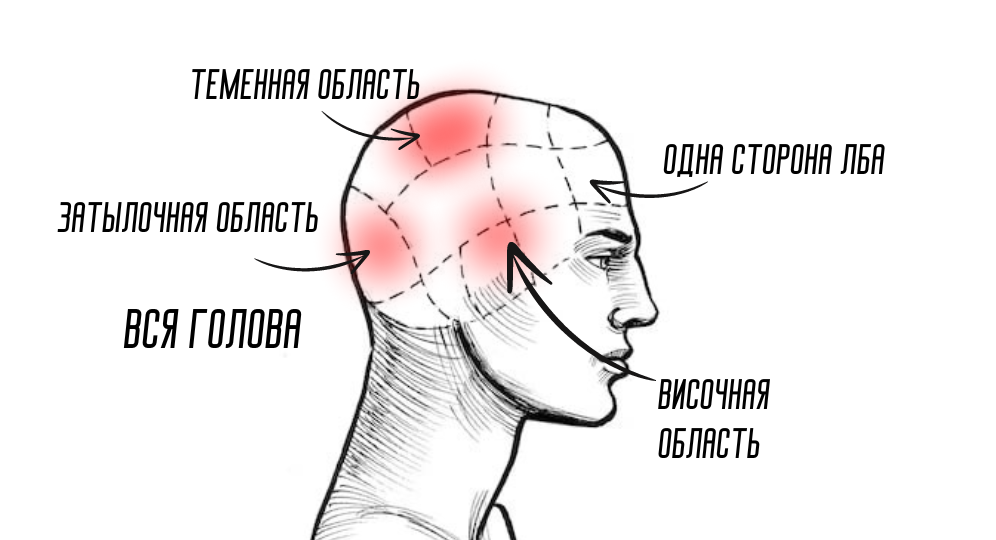 Какая головная боль опасна: виды головной боли и причины. Сохраните шпаргалку.