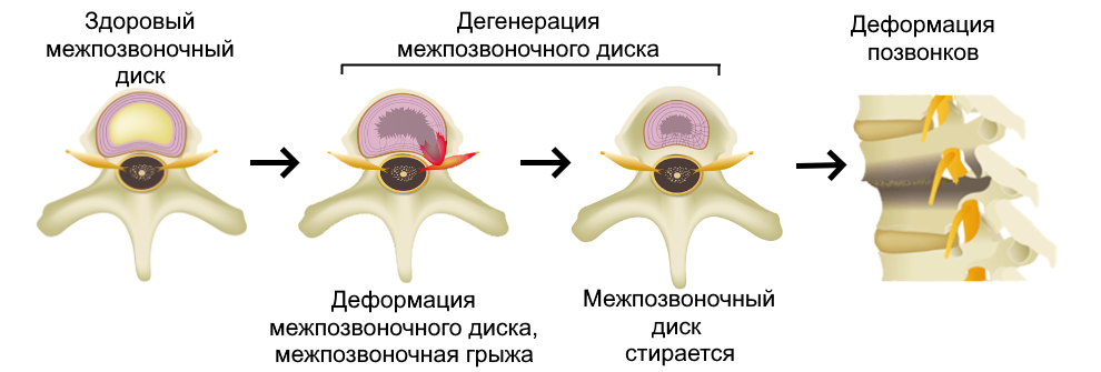 где находится диск на телефоне