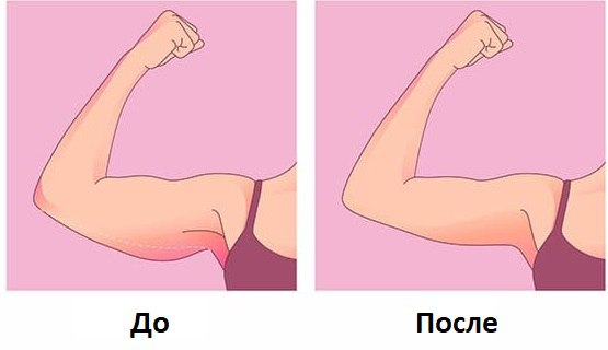 Почему обвисает кожа на руках