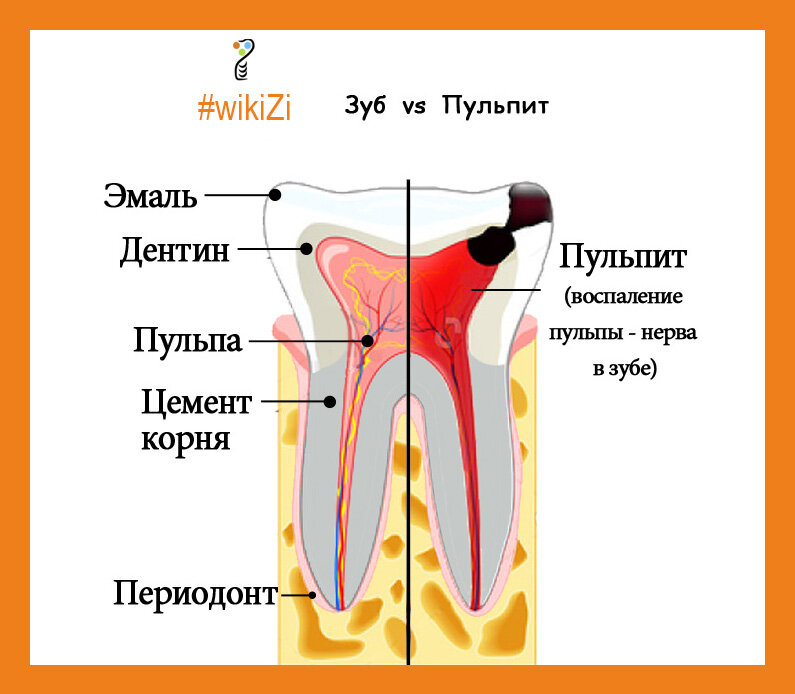 Куда девают удаленные зубы