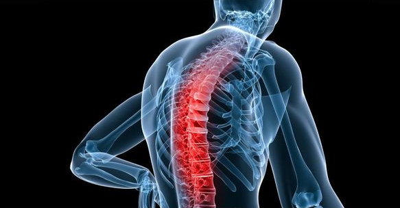 Болезнь Бехтерева