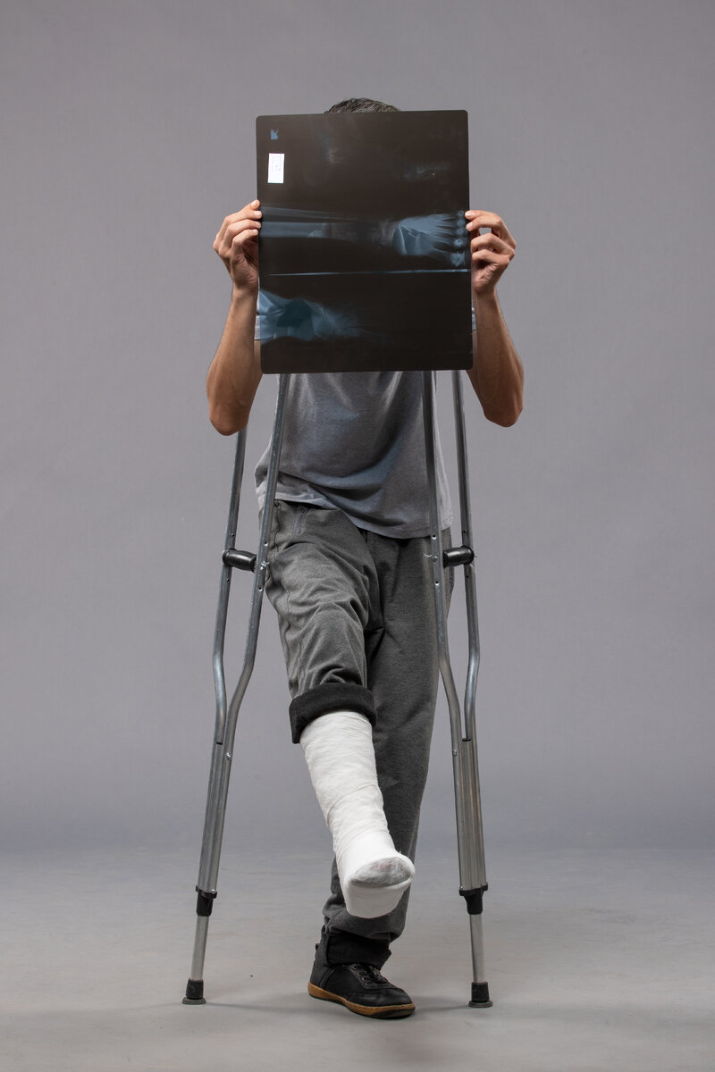 <a href="https://www.freepik.com/free-photo/front-view-young-male-sitting-with-broken-foot-holding-x-ray-it-grey-desk-twist-pain-leg-broken-male-accident-foot_16908552.htm#query=%D0%BF%D0%B5%D1%80%D0%B5%D0%BB%D0%BE%D0%BC&position=38&from_view=search&track=ais&uuid=db441b43-3d67-4eb7-b4a1-ee0412c7482d">Image by KamranAydinov</a> on Freepik