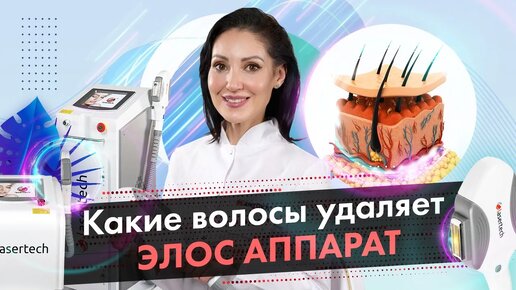 Какие волосы удаляет Элос аппарат? Элос эпиляция [LASERTECH] (18+)